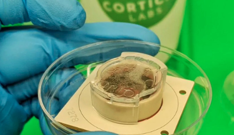 Organizoizi cerebrali umani menținuți în viață peste cinci ani: o descoperire majoră în studiul maturizării creierului