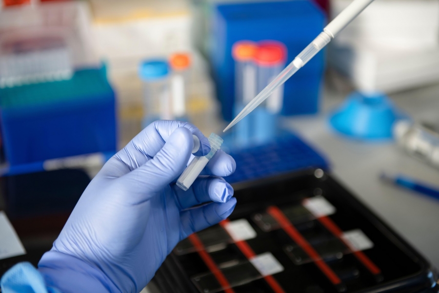 Inteligența Artificială a descoperit un nou sistem enzimatic care ar putea revoluționa editarea genetică